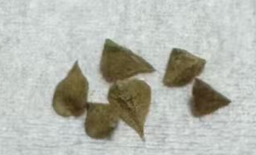 Boswellia occulta 5 seeds